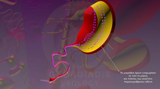 Fehérvérsejtek a sperma: okok és a fő kezelési módszerek