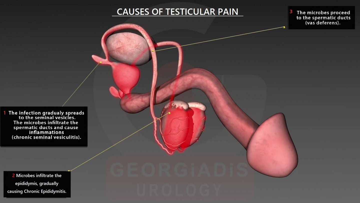 prostatitis forum testicle pain