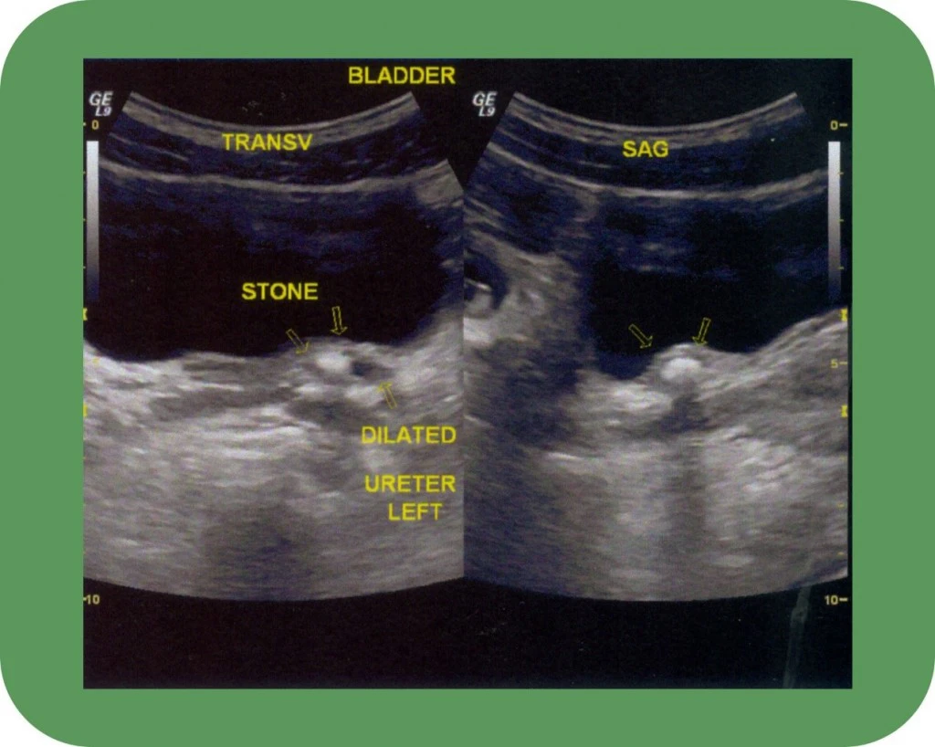Testicle ultrasound - Georgiadis Urology